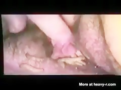 Thumb 18