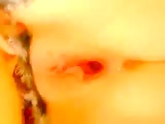 Thumb 20
